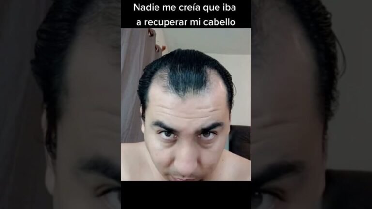 zonas crecimiento